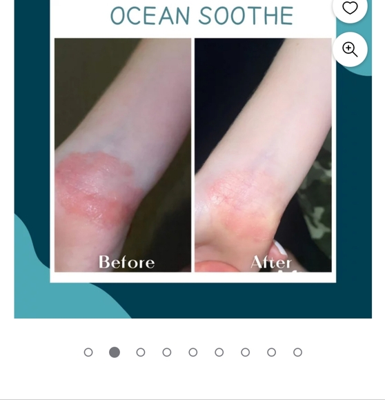 5X Abundant Ocean Soothe Gel Natural Psoriasis Relief BNIB - Picture 5 of 5